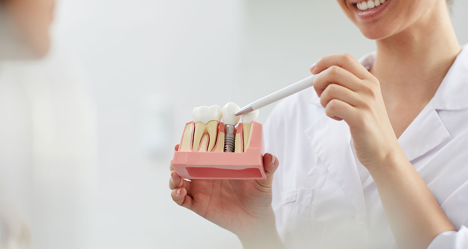 What is Dental Crown?